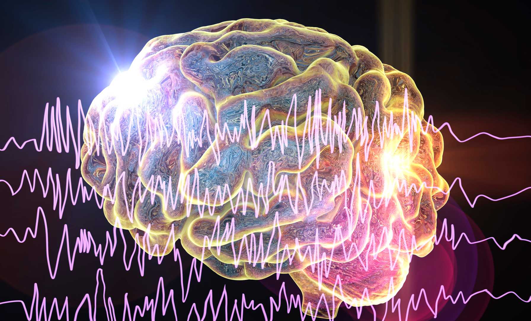 Pioneering Precision Medicine Neuromodulation Therapy for Drug-Resistant Epilepsy