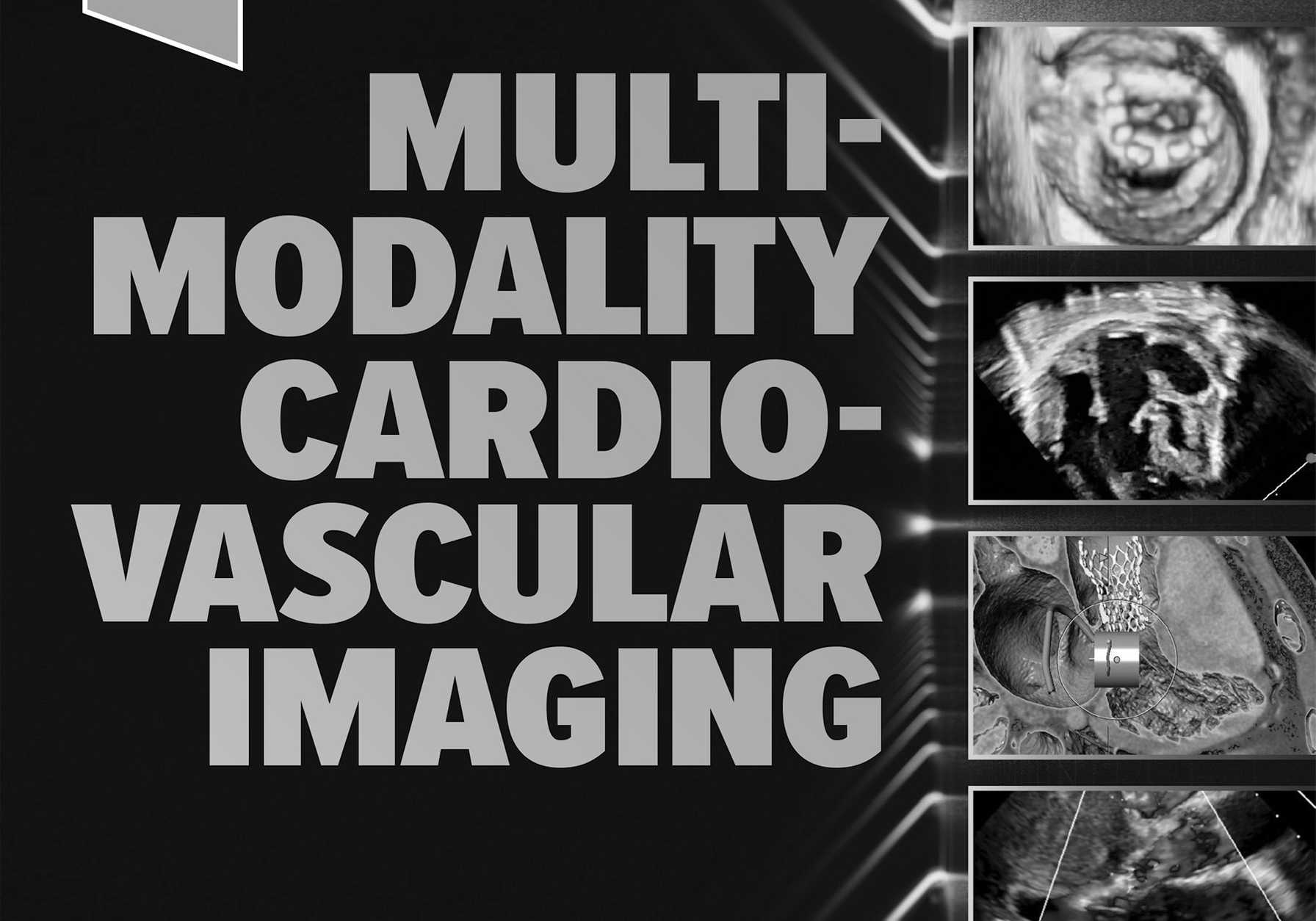 Chief of Cardiology is Editor of Newly Published Preeminent Textbook on Multimodal Cardiovascular Imaging