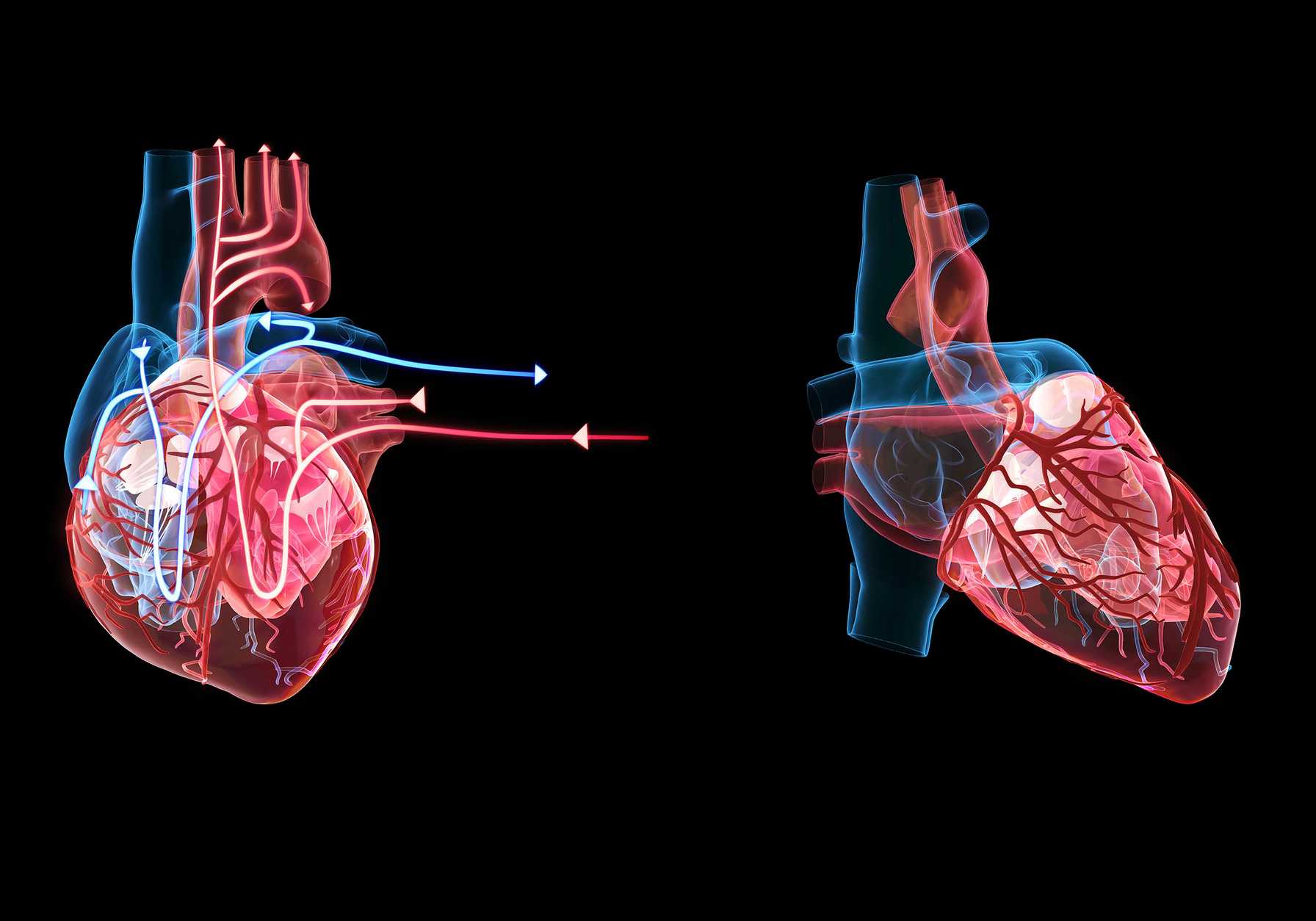 At the Forefront of Understanding the Role of Sildenafil During Heart Assist Device Support for Advanced Heart Failure