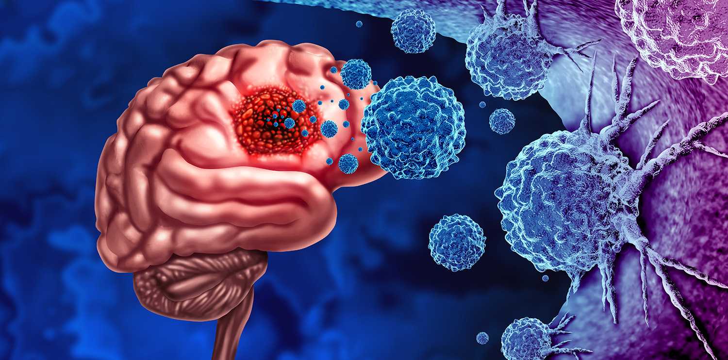 Pioneering Personalized Vaccines to Fight Brain Cancer 